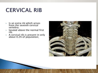 2. Typical and atypical ribs anatomy.pptx