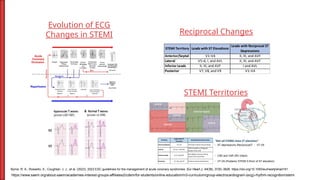 Comprehensive Clinical Practice Guide to ECG Interpretation and Common ...