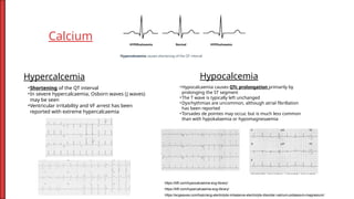Comprehensive Clinical Practice Guide to ECG Interpretation and Common ...