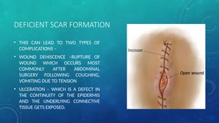 Comprehensive Overview of Wound Healing Processes and Classifications ...