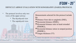 Lev Protocol Songraph 2. Dr. Lalith.pptx ultrasound abdomen trauma | PPTX