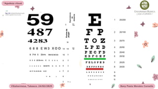 2.- Agudeza visual y ametropías.pdf.pdf