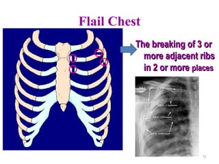 Comprehensive Overview of Trauma Management: Chest, Abdominal, and ...