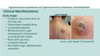 Winterbutton Sign Comprehensive Overview of Parasite Infection Pathophysiology and ...