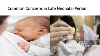 Comprehensive Neonatal Care: Physiology, Reflexes, and Clinical Focus ...
