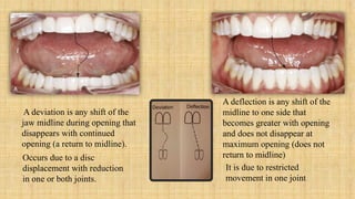 Temporomandibular Joint (TMJ) | PPTX