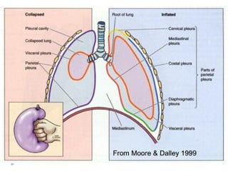 Comprehensive Overview of Pleural Effusion: Anatomy, Diagnosis, and ...