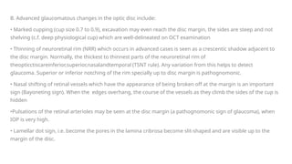 Comprehensive Overview of Primary Open-Angle Glaucoma: Diagnosis ...