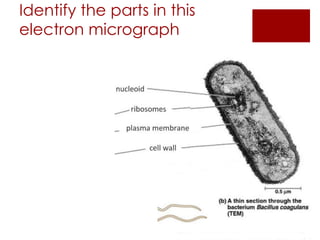 Identify the parts in this
electron micrograph
 