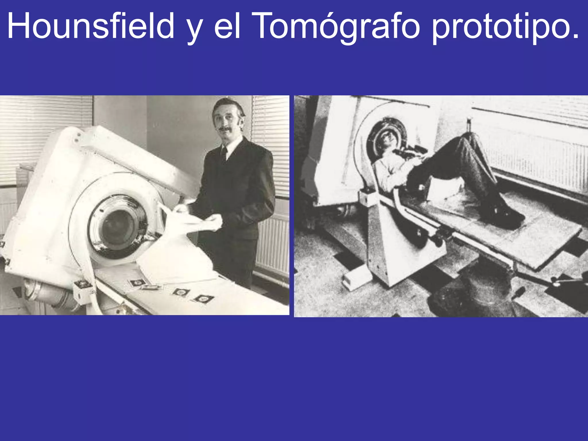 Hounsfield y el Tomógrafo prototipo.
 