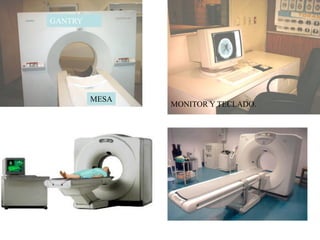 Figure 8 from Desentrañando la tecnología de la tomografía computarizada  helicoidal multicorte (TCMC)