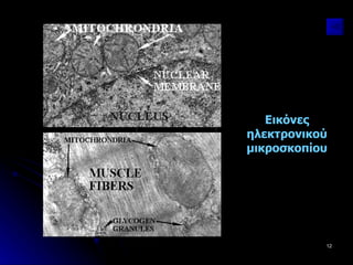 Εικόνες ηλεκτρονικού μικροσκοπίου 