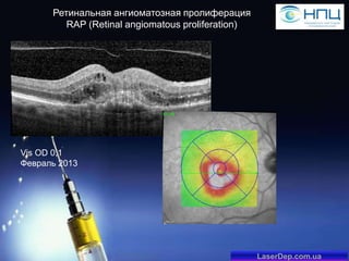 Ретинальная ангиоматозная пролиферация
RAP (Retinal angiomatous proliferation)

Vis OD 0,1
Февраль 2013

LaserDep.com.ua

 