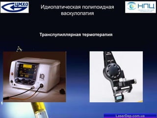 Идиопатическая полипоидная
васкулопатия

Транспупиллярная термотерапия

LaserDep.com.ua

 