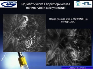Идиопатическая переферическая
полипоидная васкулопатия

Пациентке назначена ФЭК+ИОЛ на
октябрь 2013

LaserDep.com.ua

 