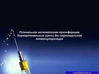 Ретинальная ангиоматозная пролиферация
Хориоретинальные шунты без хориоидальной
неоваскуляризации

LaserDep.com.ua

 