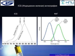 ICG (Индоцианин-зеленая) ангиография

ICG

ФАГ

LaserDep.com.ua

 