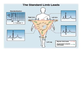 2.4 electrocardiograma
