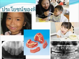 ประโยชน์ของฟันนำ้านม
 