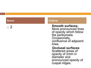 Score


2

Criteria

Smooth surfaces;
More pronounced lines
of opacity which follow
the perikymata.
Occasionally,
confluence of adjacent
lines.
Occlusal surfaces:
Scattered areas of
opacity of 2mm in
diameter and
pronounced opacity of
cuspal ridges.

 
