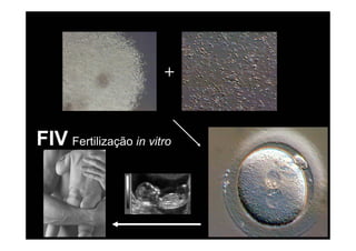 +



FIV Fertilização in vitro
 