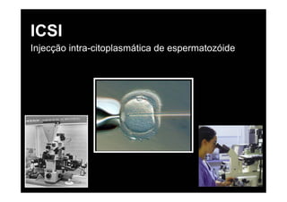 ICSI
Injecção intra-citoplasmática de espermatozóide
 