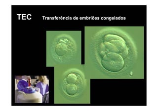 TEC   Transferência de embriões congelados
 