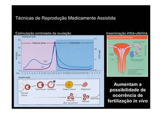Técnicas de Reprodução Medicamente Assistida


Estimulação controlada da ovulação     Inseminação intra-uterina




                                           Aumentam a
                                         possibilidade de
                                          ocorrência de
                                        fertilização in vivo
 