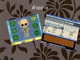 ตัวอย่าง
 