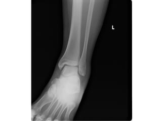 Normal Rug X Ray 2.8 x ray studies | PPT