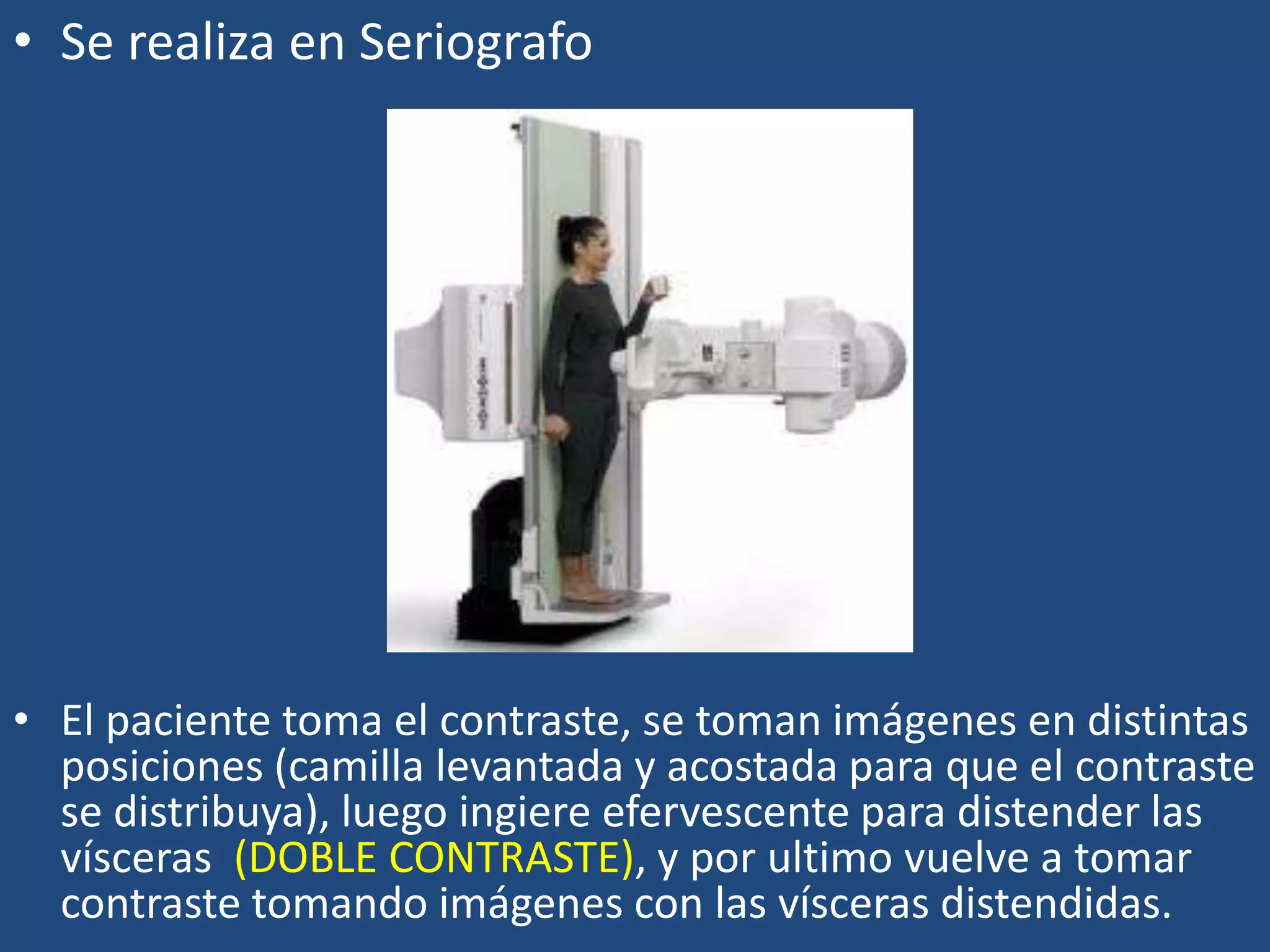 • Se realiza en Seriografo
• El paciente toma el contraste, se toman imágenes en distintas
posiciones (camilla levantada y acostada para que el contraste
se distribuya), luego ingiere efervescente para distender las
vísceras (DOBLE CONTRASTE), y por ultimo vuelve a tomar
contraste tomando imágenes con las vísceras distendidas.
 