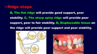 Segmented Ridge Shape 2- a. Basic principles for designing the removable partial denture ...