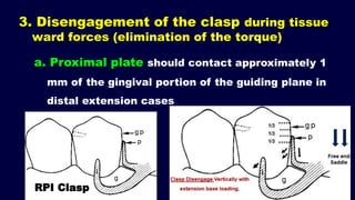 Rpi Clasp Rpd 2- a. Basic principles for designing the removable partial denture ...