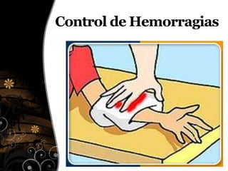 Control de Hemorragias