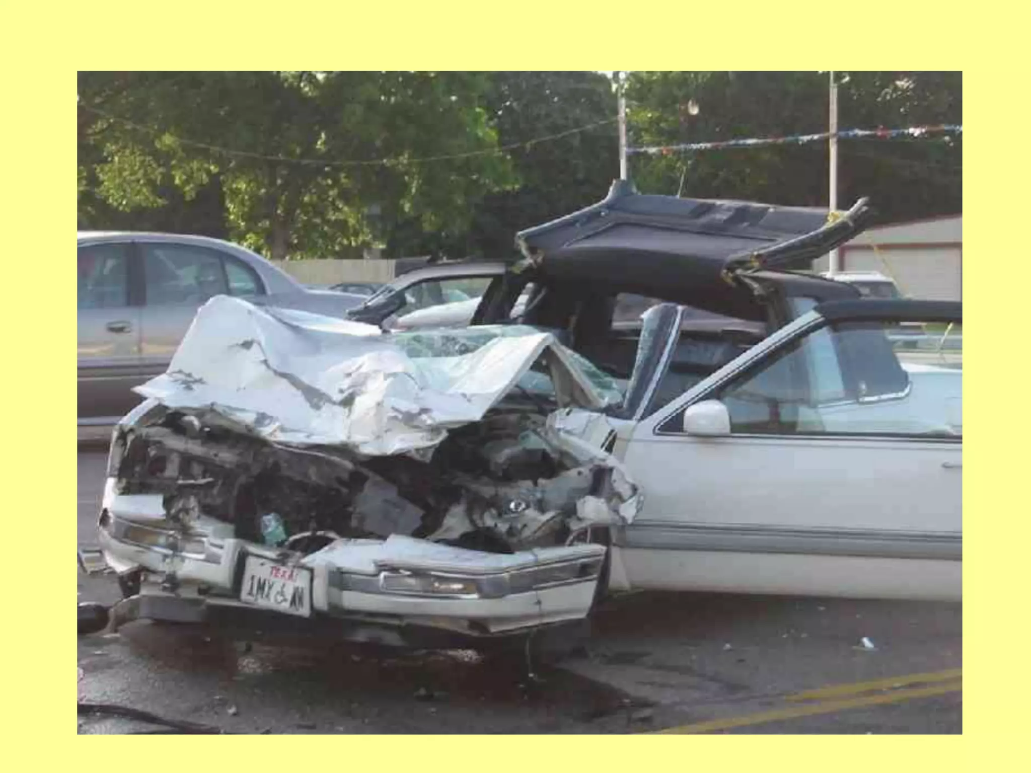 2 - ABDOMINAL TRAUMA.ppt