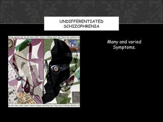 UNDIFFERENTIATED
 SCHIZOPHRENIA


                   Many and varied
                     Symptoms.
 