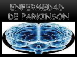 ENFERMEDAD  DE PARKINSON 