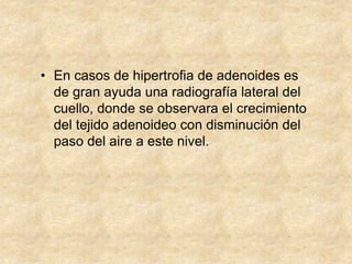 • En casos de hipertrofia de adenoides es
de gran ayuda una radiografía lateral del
cuello, donde se observara el crecimiento
del tejido adenoideo con disminución del
paso del aire a este nivel.
 
