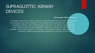 2- Airway Management.pptx Air way management Air way management Air way ...