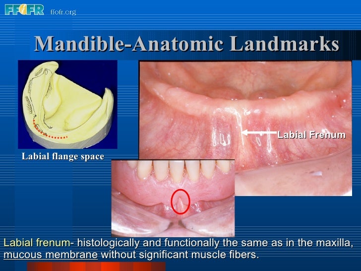 2.anatomy of the denture foundation areas