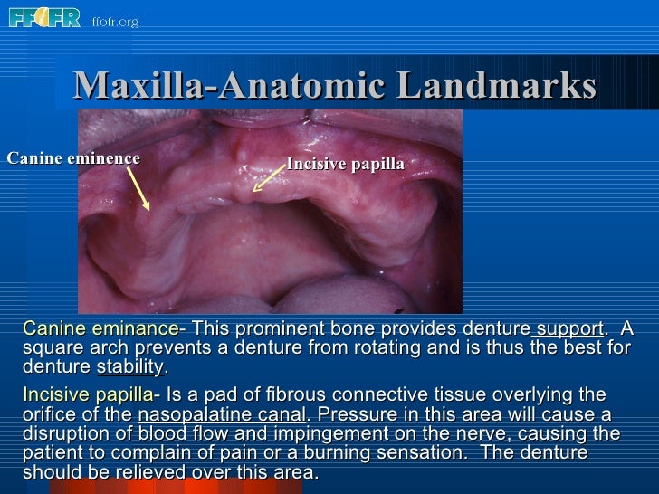 2.anatomy of the denture foundation areas