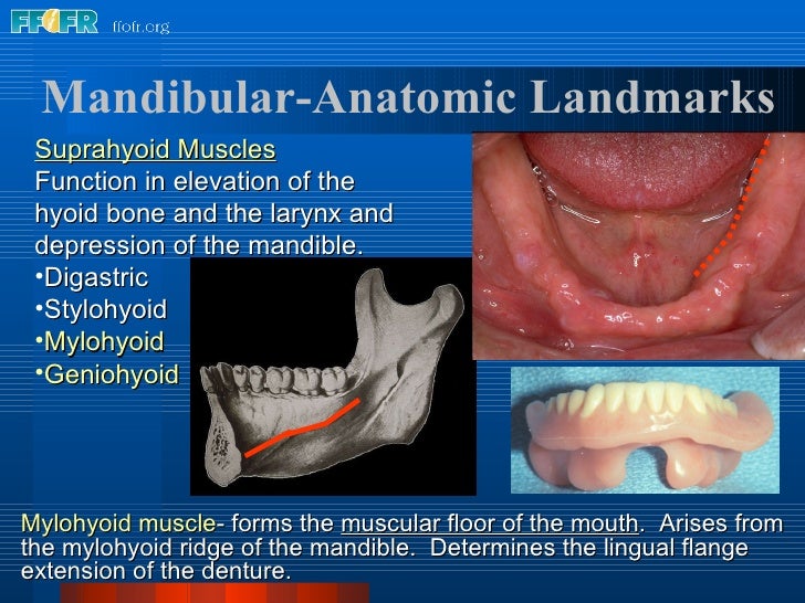 Denture Base Area  - In Conclusion, Potent Antifungal Effects Of Agnp Coating Of Denture Base Material Were Demonstrated In Vitro, As Shown By.