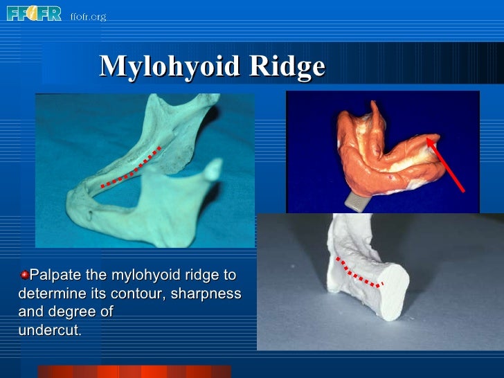 2.anatomy of the denture foundation areas