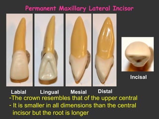 Permanent Maxillary Lateral Incisor
Labial Lingual Mesial Distal
Incisal
-The crown resembles that of the upper central
- It is smaller in all dimensions than the central
incisor but the root is longer
 