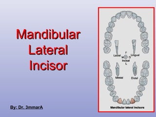 MandibularMandibular
LateralLateral
IncisorIncisor
By: Dr. 3mmarA
 