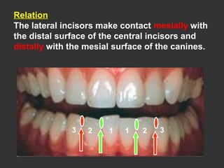 Relation
The lateral incisors make contact mesially with
the distal surface of the central incisors and
distally with the mesial surface of the canines.
11 223 3
 