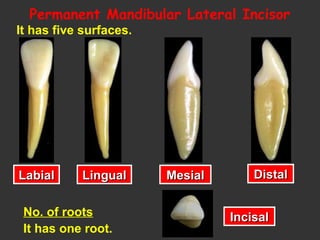 It has five surfaces.
No. of roots
It has one root.
LabialLabial LingualLingual MesialMesial DistalDistal
IncisalIncisal
Permanent Mandibular Lateral Incisor
 