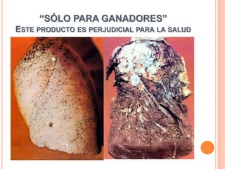 “SÓLO PARA GANADORES”
ESTE PRODUCTO ES PERJUDICIAL PARA LA SALUD
 