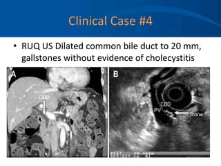 Clinical Case #4
• RUQ US Dilated common bile duct to 20 mm,
gallstones without evidence of cholecystitis
 