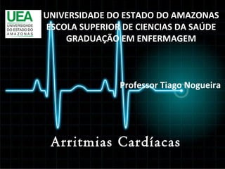 UNIVERSIDADE DO ESTADO DO AMAZONAS
ESCOLA SUPERIOR DE CIENCIAS DA SAÚDE
GRADUAÇÃO EM ENFERMAGEM

Professor Tiago Nogueira

Arritmias Cardíacas

 